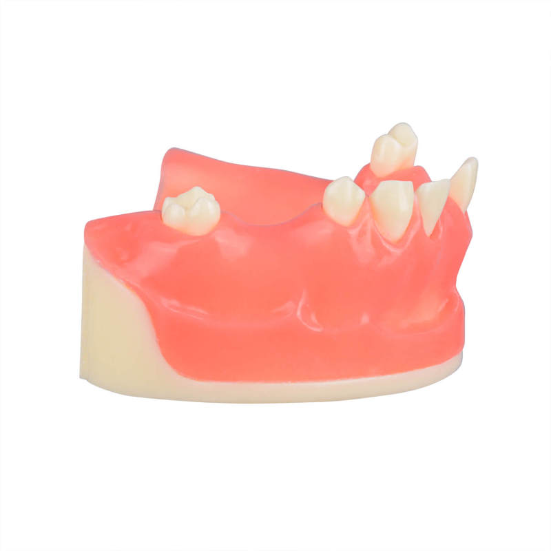 Orthognathic Surgery Maxillary Sinus Lift Training Model, Missing Teeth 12, 13, 15, 16, 17, 21, 25, 26