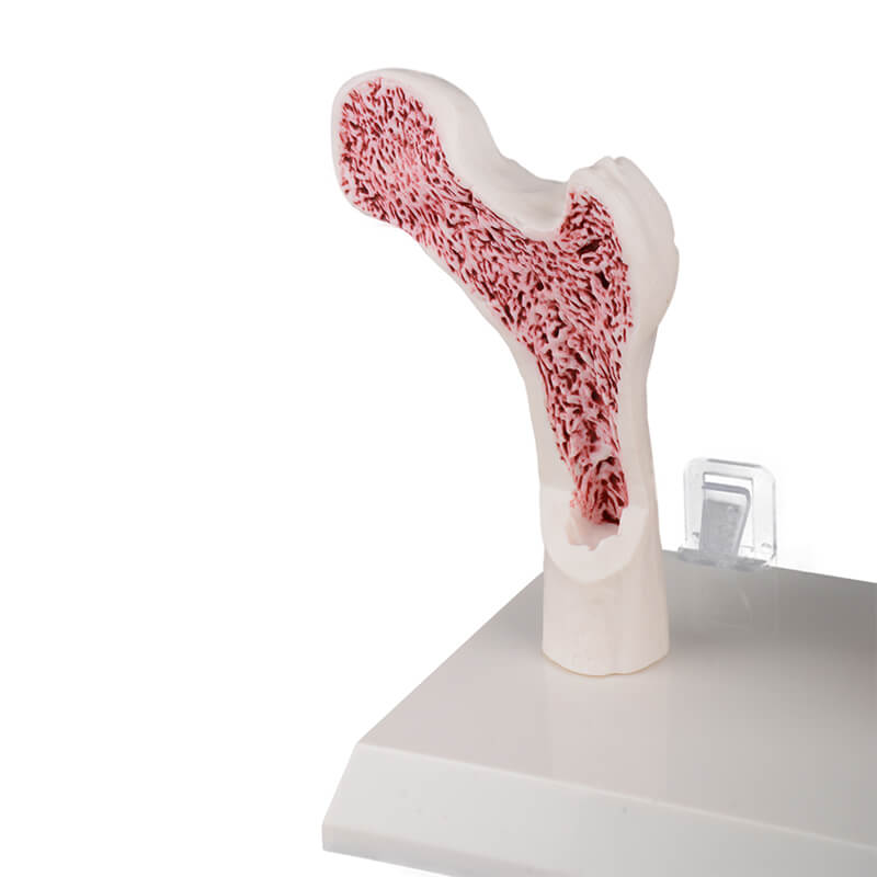 Menopausal Osteoporosis Model (OP Femur & 4 Vertebrae) for Medical Teaching