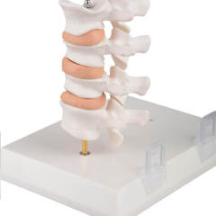 Menopausal Osteoporosis Model (OP Femur & 4 Vertebrae) for Medical Teaching