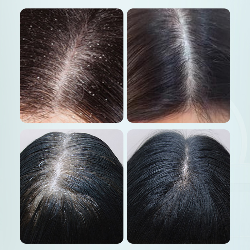 Ginger Hydrate And Nourish Shampoo