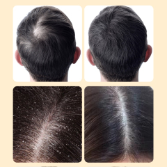 Ginseng Promote Scalp Blood Circulation And Hair Growth Hair Shampoo