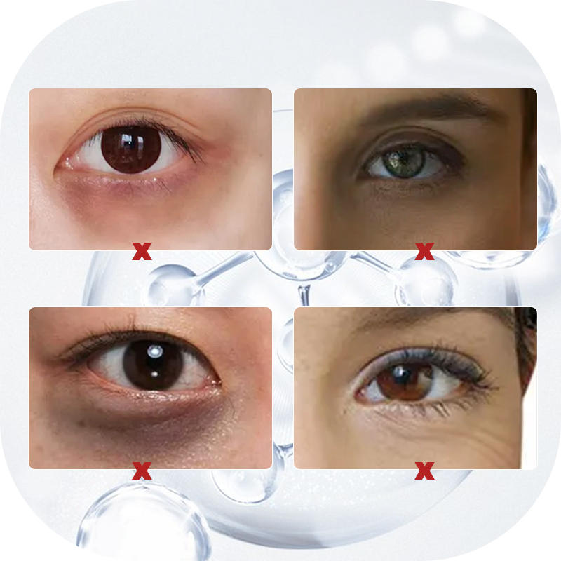 Nicotinamide Whitening Anti Wrinkle Eyes Cream