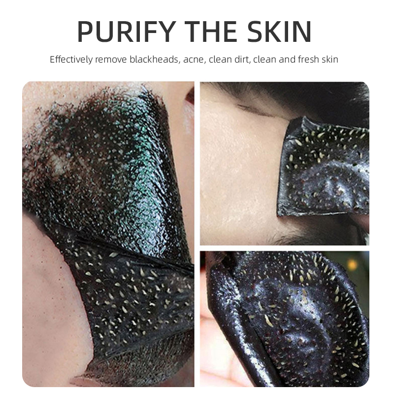 Mild And Not Irritating Blackhead Remover Facial Peel Off Mask