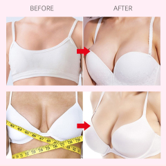 Proprietary Formula Breast Enlargement And Firmness Cream