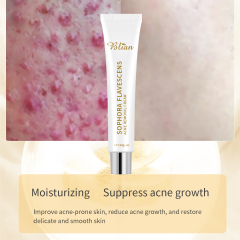 Sophora Flavescens Chinese Herbal Ance Treatment Face Cream