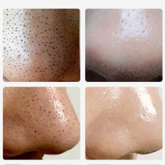 Mild And Not Irritating Blackhead Remover Facial Peel Off Mask