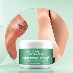 Cracked Foot Skin Repair Cream