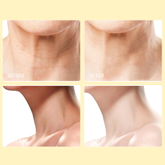 Neck Wrinkle Removal Firming Whitening Cream