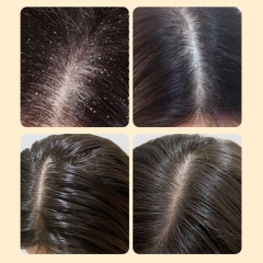 Ginseng Promote Scalp Blood Circulation And Hair Growth Hair Conditioner