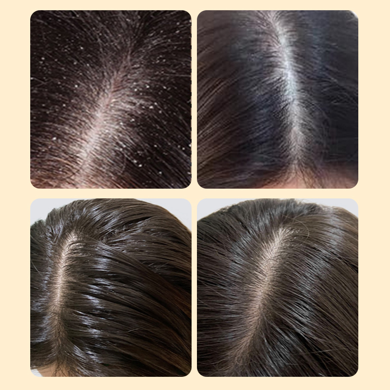 Ginseng Promote Scalp Blood Circulation And Hair Growth Hair Conditioner
