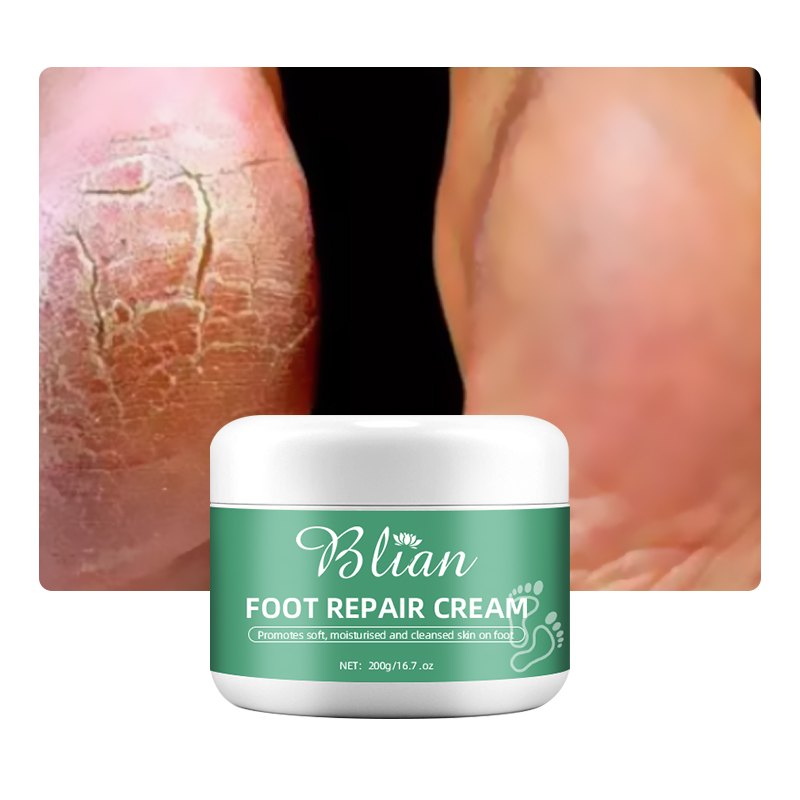 Cracked Foot Skin Repair Cream