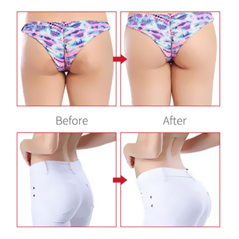 Proprietary Formula Buttocks Enlargement And Firmness Cream