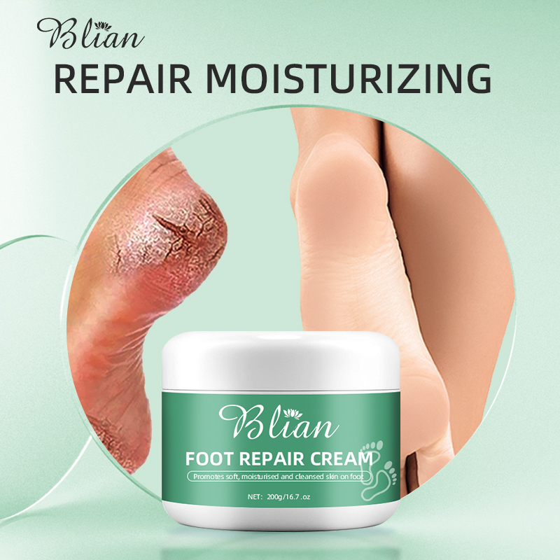 Cracked Foot Skin Repair Cream
