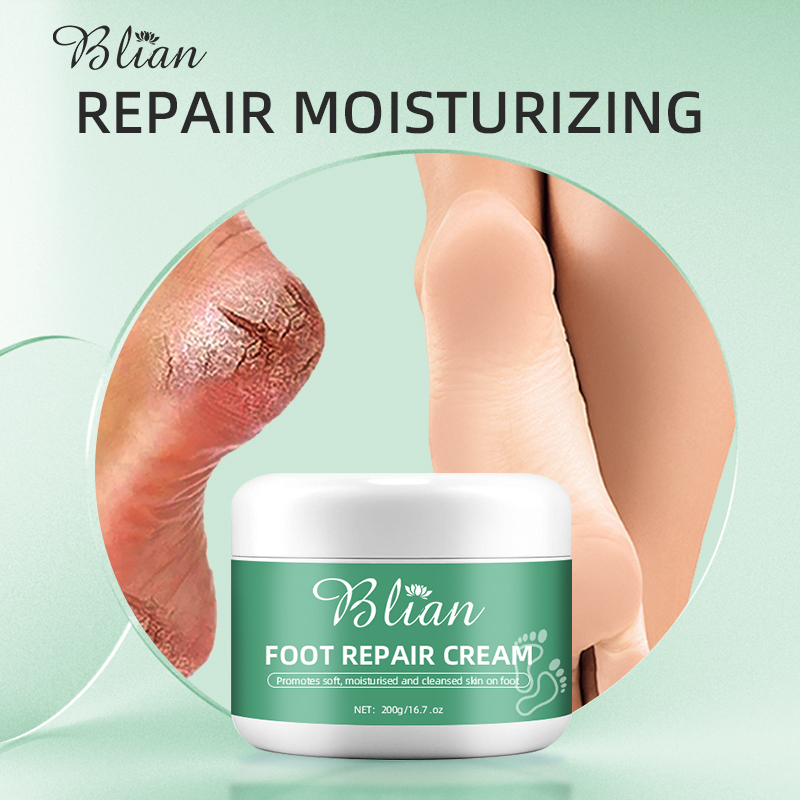 Cracked Foot Skin Repair Cream
