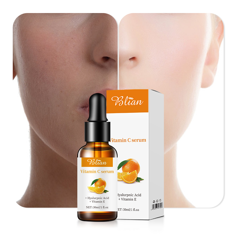 Vitamin C Whitening Freckle Removal And Brightening Facial Serum