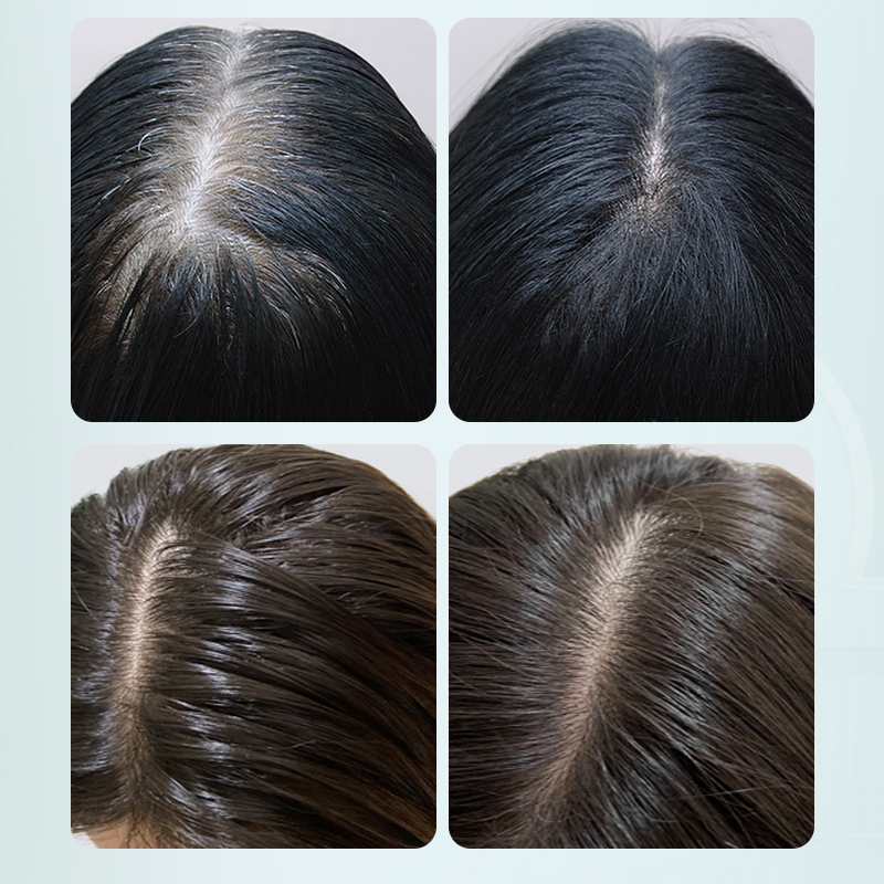 Ginger Nourishes Scalp Protects Hair Roots And Prevents Hair Loss Hair Conditioner