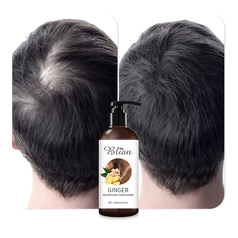 Ginger Nourishes Scalp Protects Hair Roots And Prevents Hair Loss Hair Conditioner
