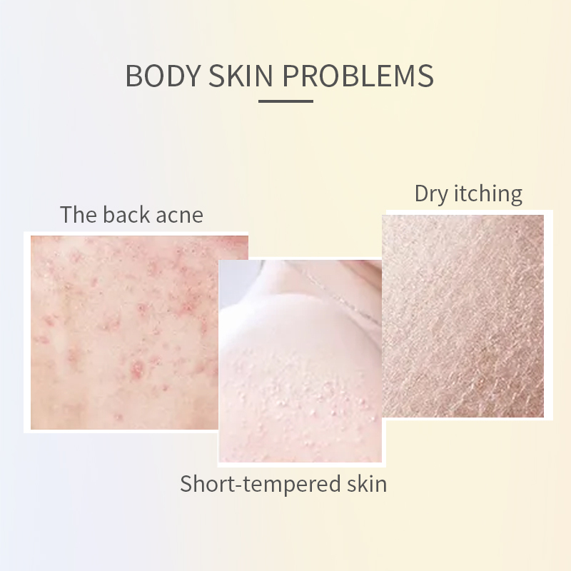 Turmeric Sterilize And Nourish Skin Body Shower Gel