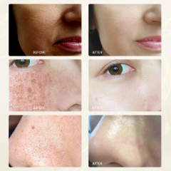 Rice Moisturizing Facial Cream