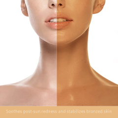 Soothing Oil After Sun Moisturizing, Repair Body Oil