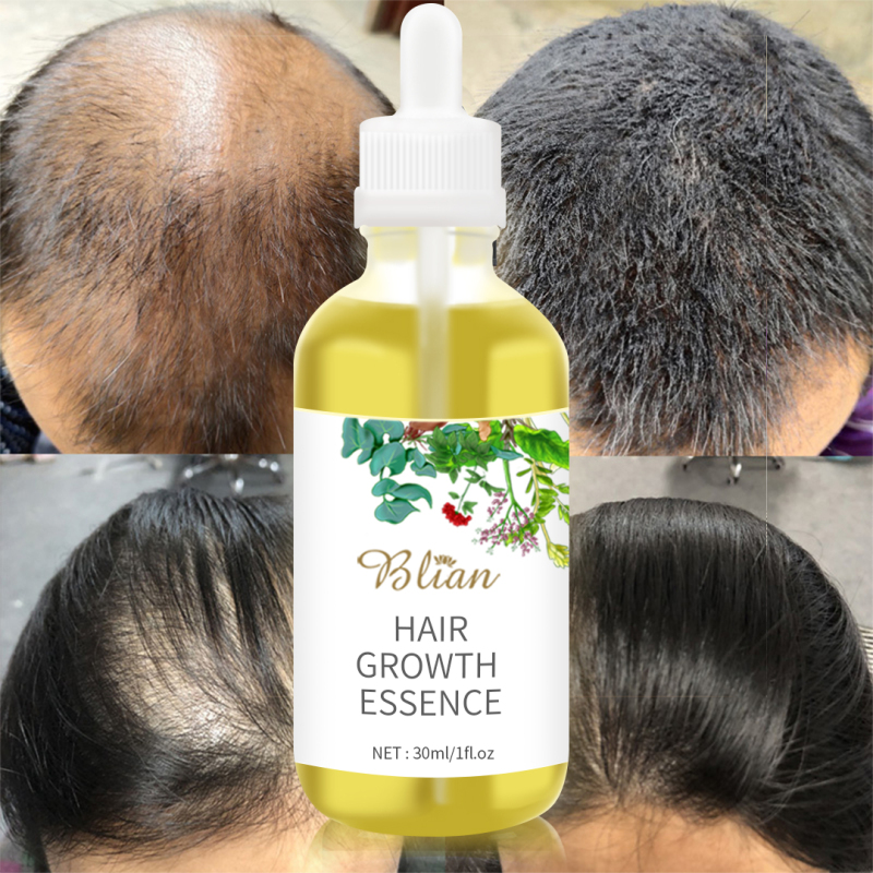 Hair Growth Oil Hair Serum