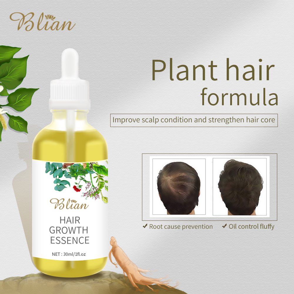 Hair Growth Oil Hair Serum