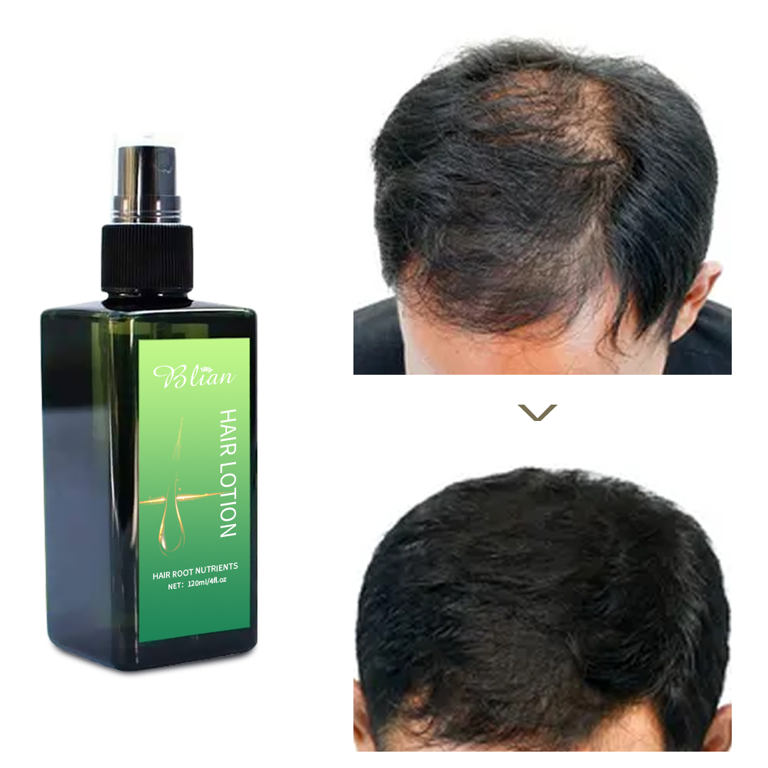 Root Development Nutrition Hair Essential Oil