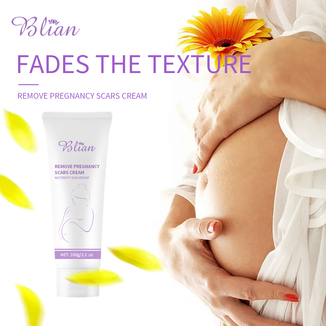 Centella Asiatica Extractsreduce Stretch Marks Moisturisebellycream