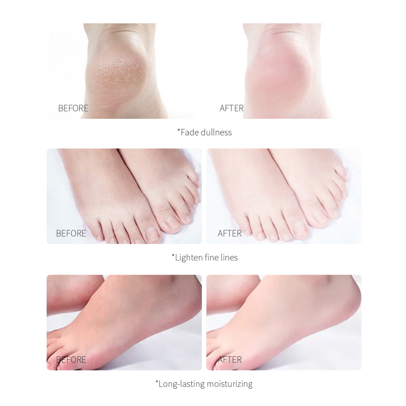 Coconut Moisturizing And Smooth Lighten Dry Lines Foot Mask