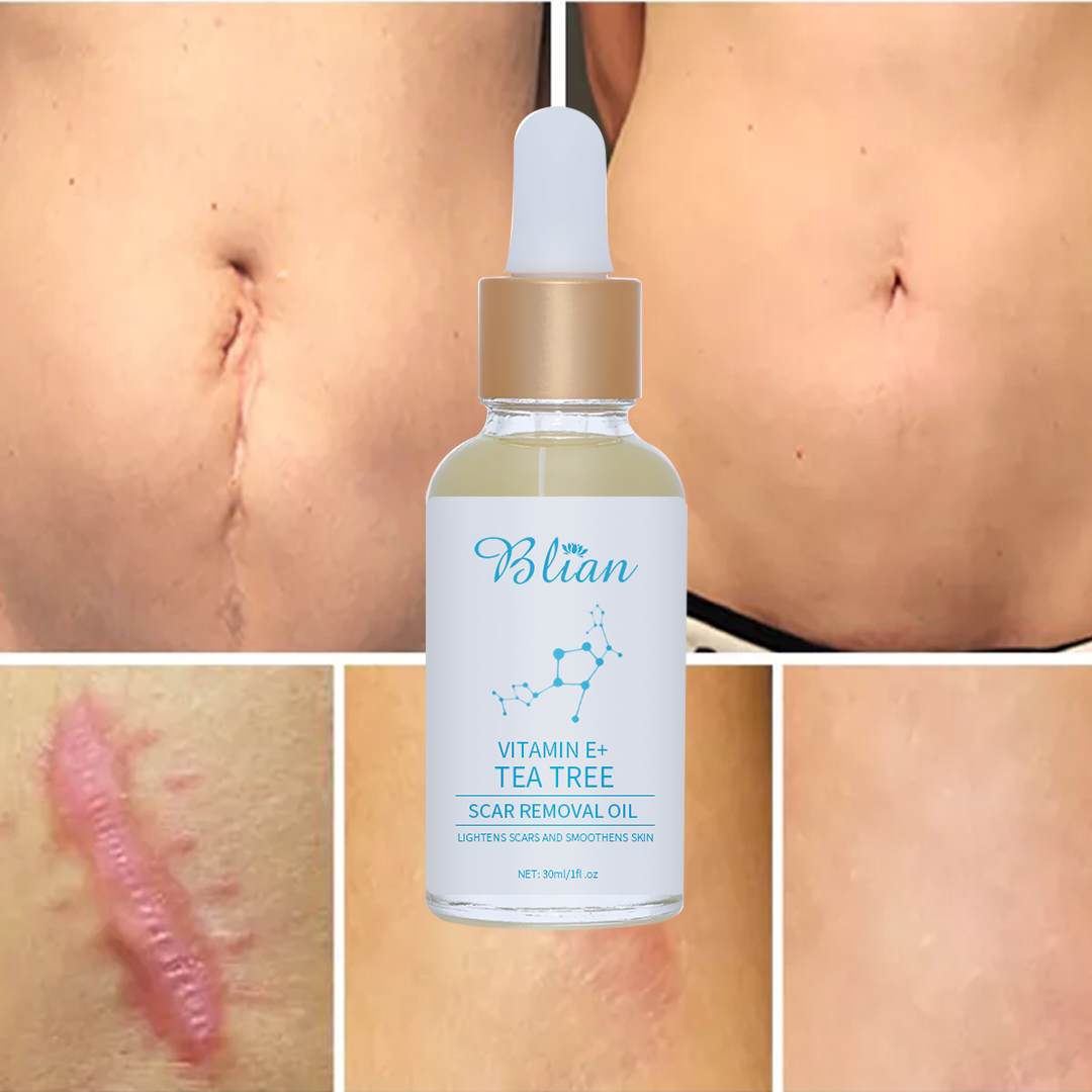 Lavender Remove Scar Body Oil