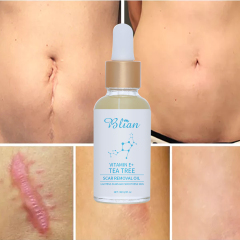 Lavender Remove Scar Body Oil