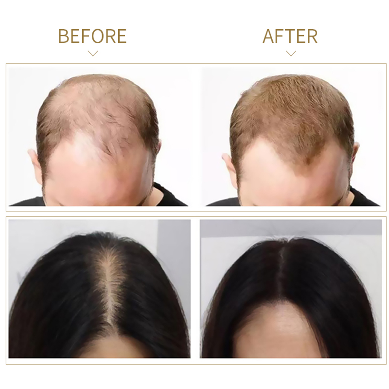 Ginseng Angelica Hair Growth Massage Essence