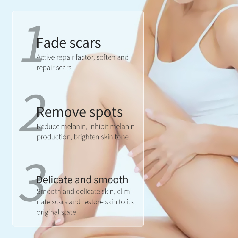 Angelica Sinensis Acne Removing & Scar Fading Body Cream
