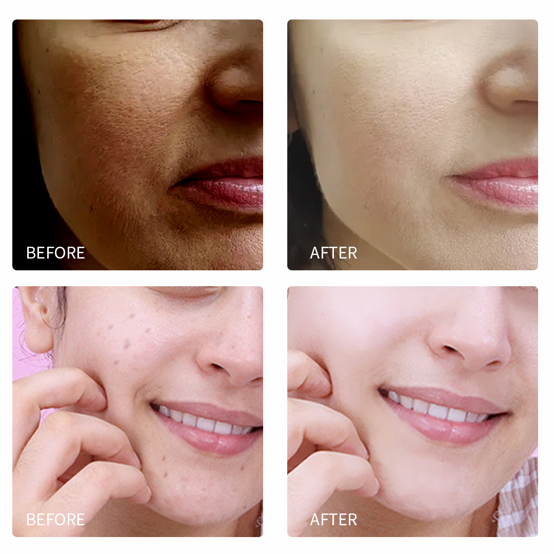Turmeric Whitening And Brightening Facial Cream