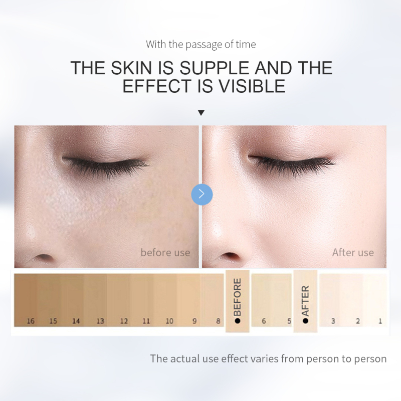 Nicotinamide Whitening, Light Spots Facial Skin Care Set