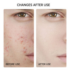 Men's face care cleansing oil control and moisturizing set