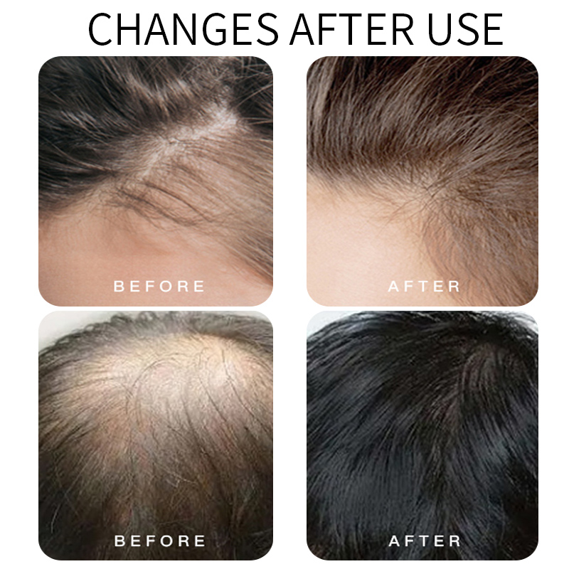 Sidebark Serum Hair Care Essence Set