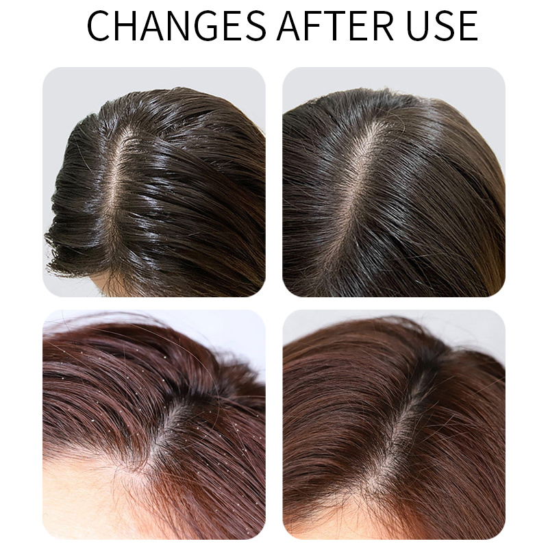 300ml Ginger Treatment Shampoo