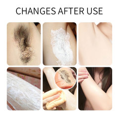 Non-stimulating hair removal cream