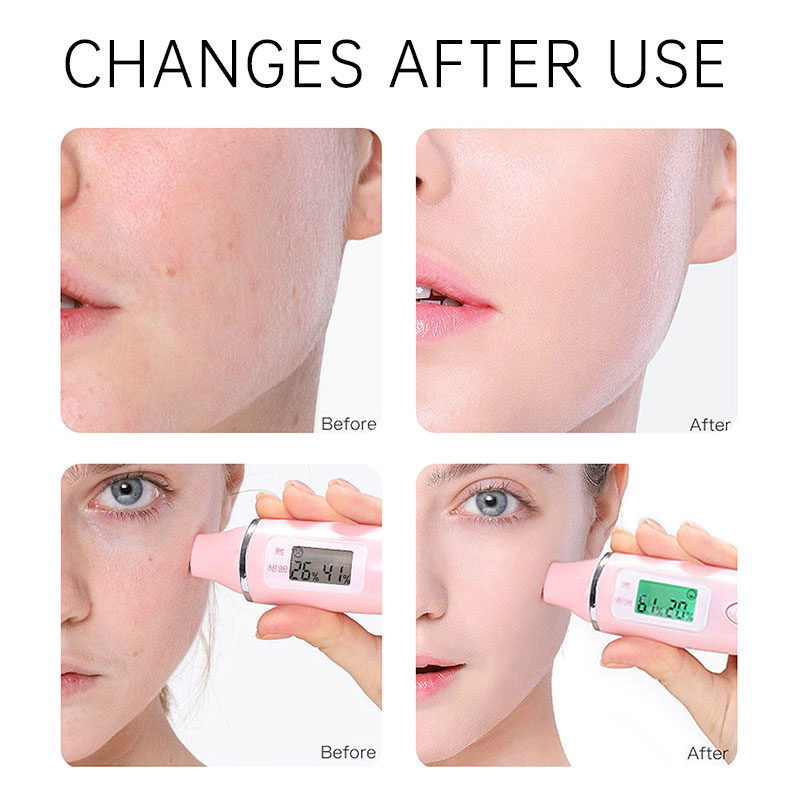 Rose Facial Toner