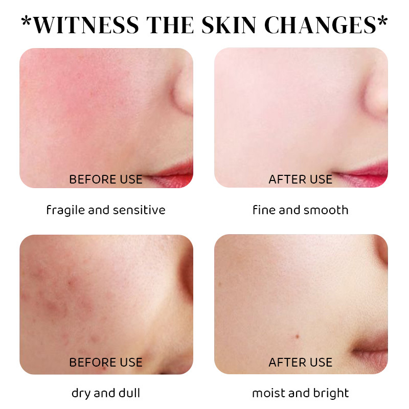 Centella Asiatica Extract Massage Oil