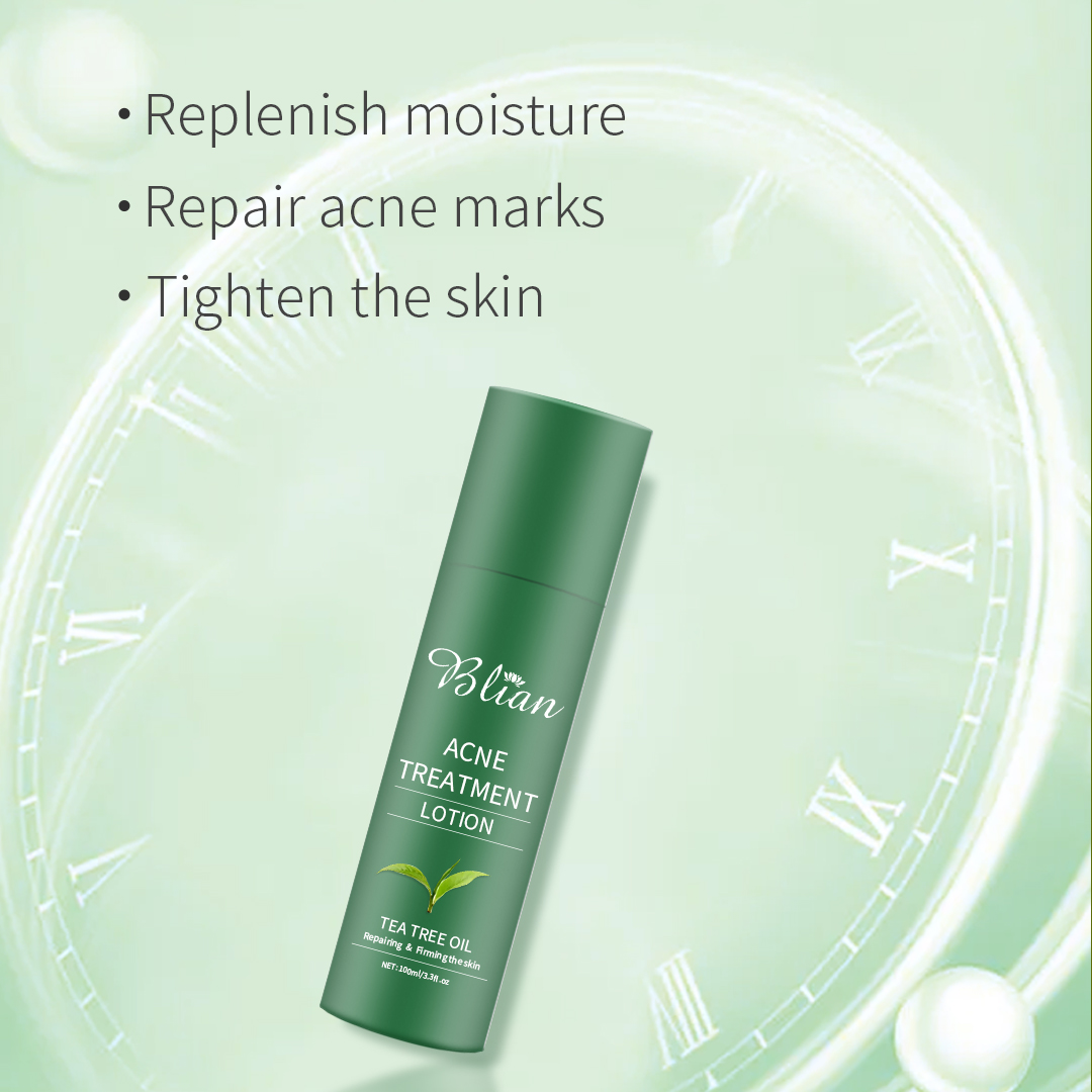 Tea Tree Extract Acne Facial Lotion