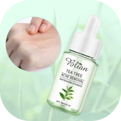 Tea Tree Extract Acne Facial Serum