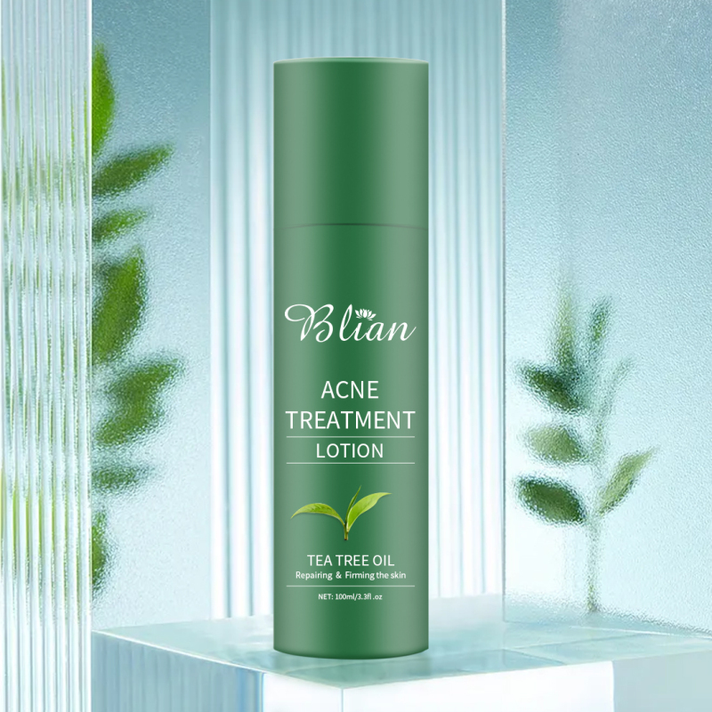 Tea Tree Extract Acne Facial Lotion
