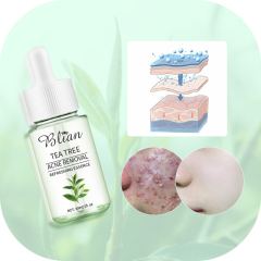 Tea Tree Extract Acne Facial Serum
