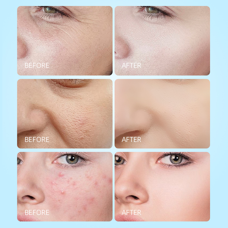 Hydrating and Moisturizing Facial Wash