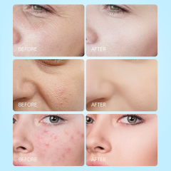 Hydrating and Moisturizing Facial Wash