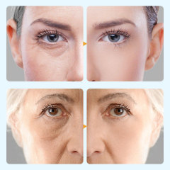 Pro-xylane Essence Anti-Aging Facial Treatment Set