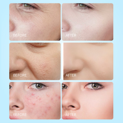 Hydrating and Moisturizing Facial Care Set