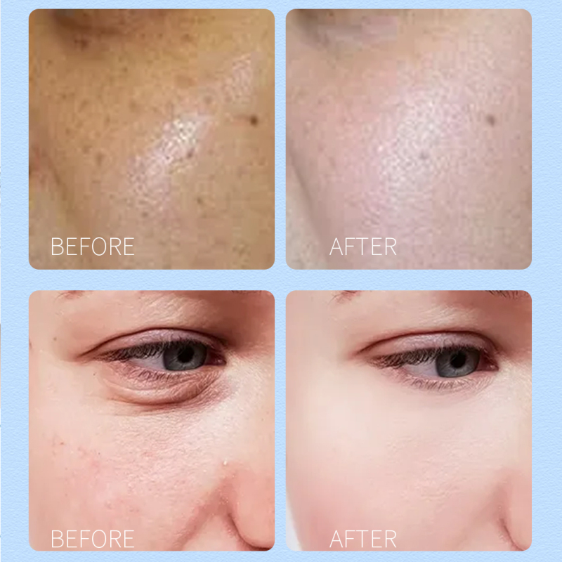 Blueberry Extract Whitening Mud Mask